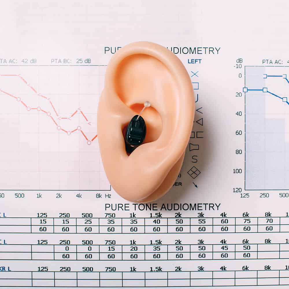 Hearing Evaluation